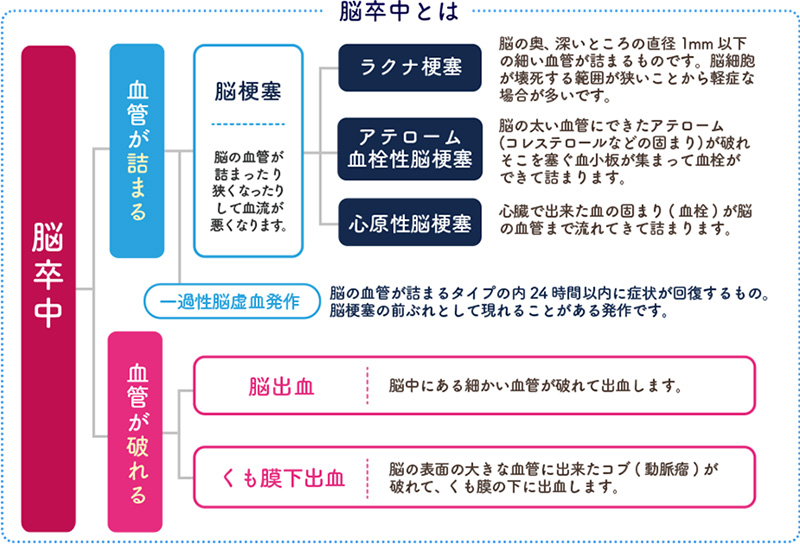 脳卒中についての図解